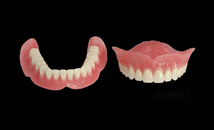 Full arch acrylic denture