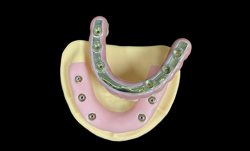 Implant bar with bridge in one piece