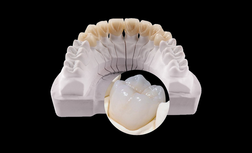 Zirconia Layered
