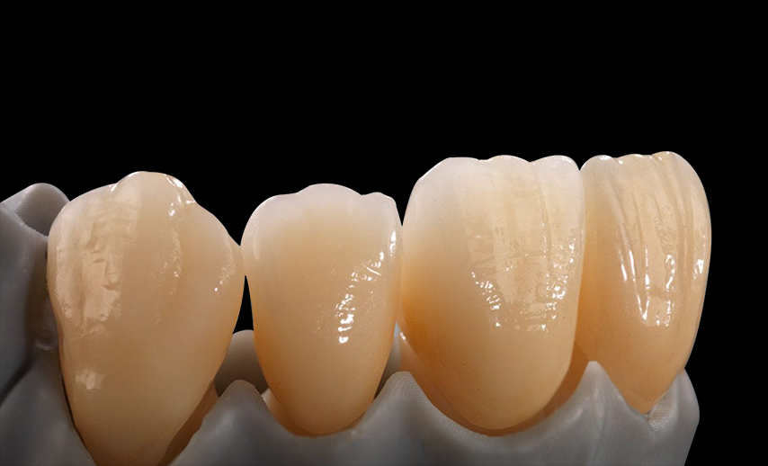 Zirconia Layered