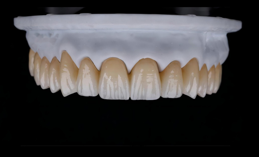 Mutilayered  Zirconia