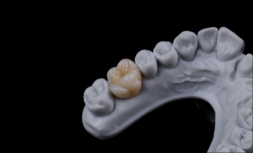 Mutilayered  Zirconia