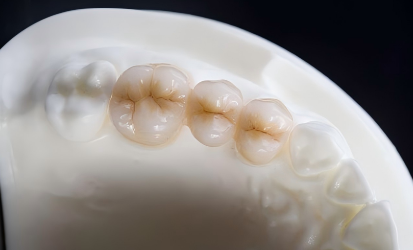 Full zirconia
