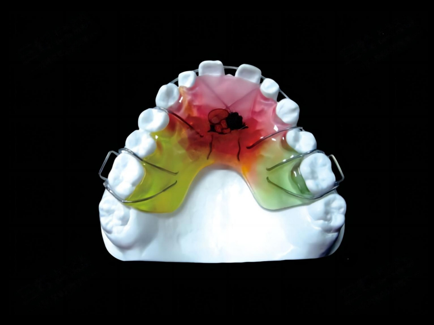 Orthodontic
