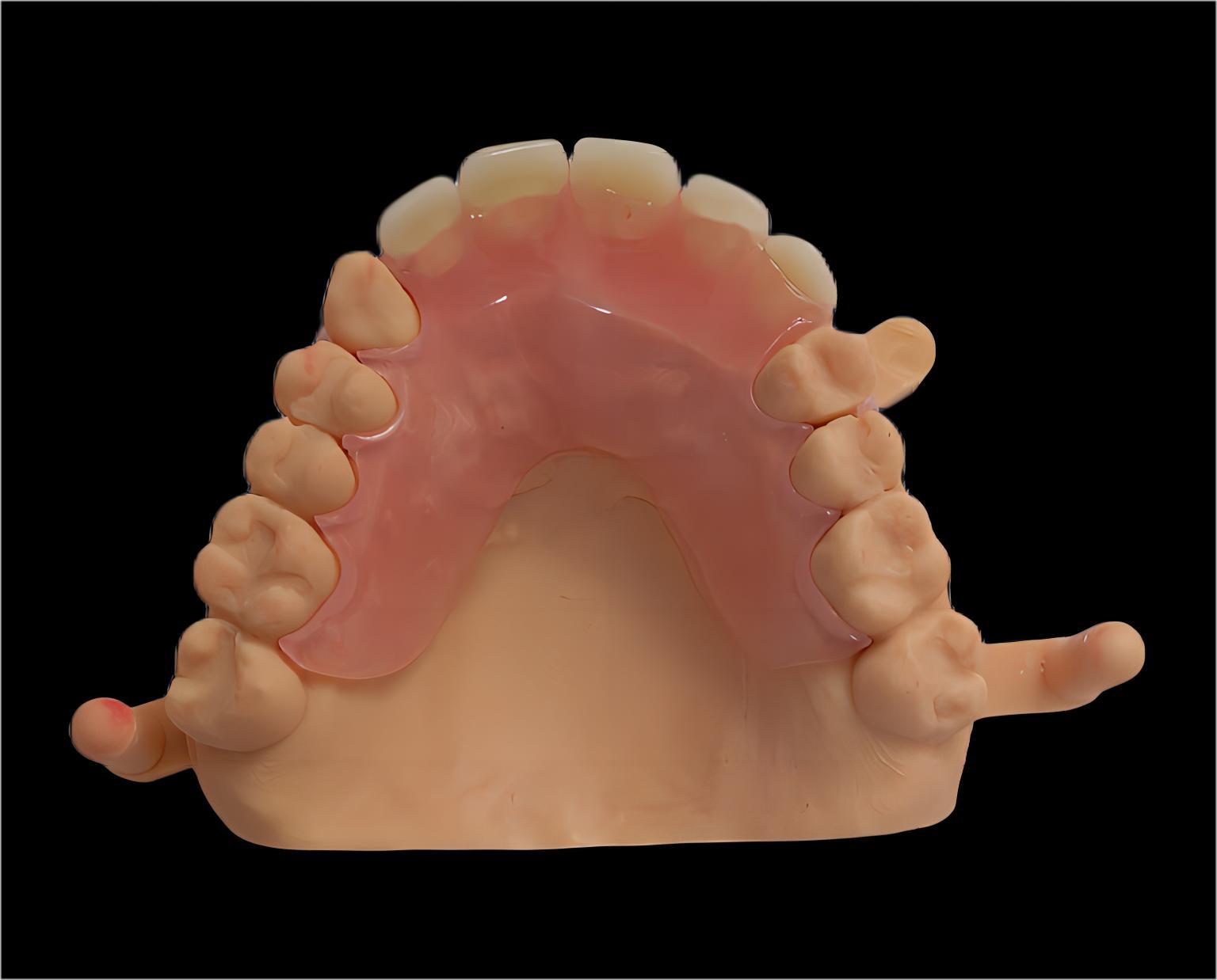 Vaplast/Flexible Denture