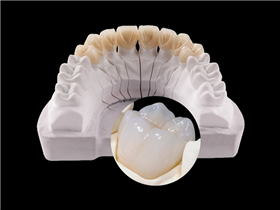 Zirconia Layered