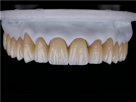Mutilayered  Zirconia