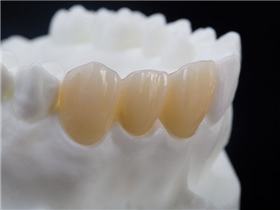 Full zirconia