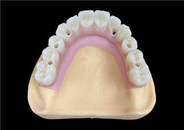 Implant bar with bridge in one piece