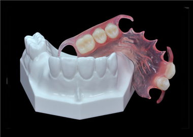 Valplast/Flexible  partial  denture