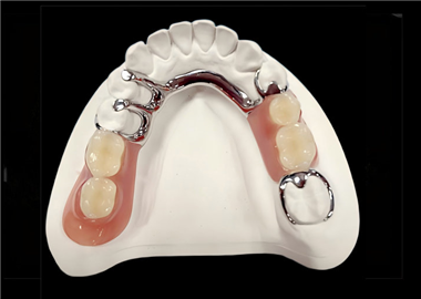 Cast  framework  with  teeth